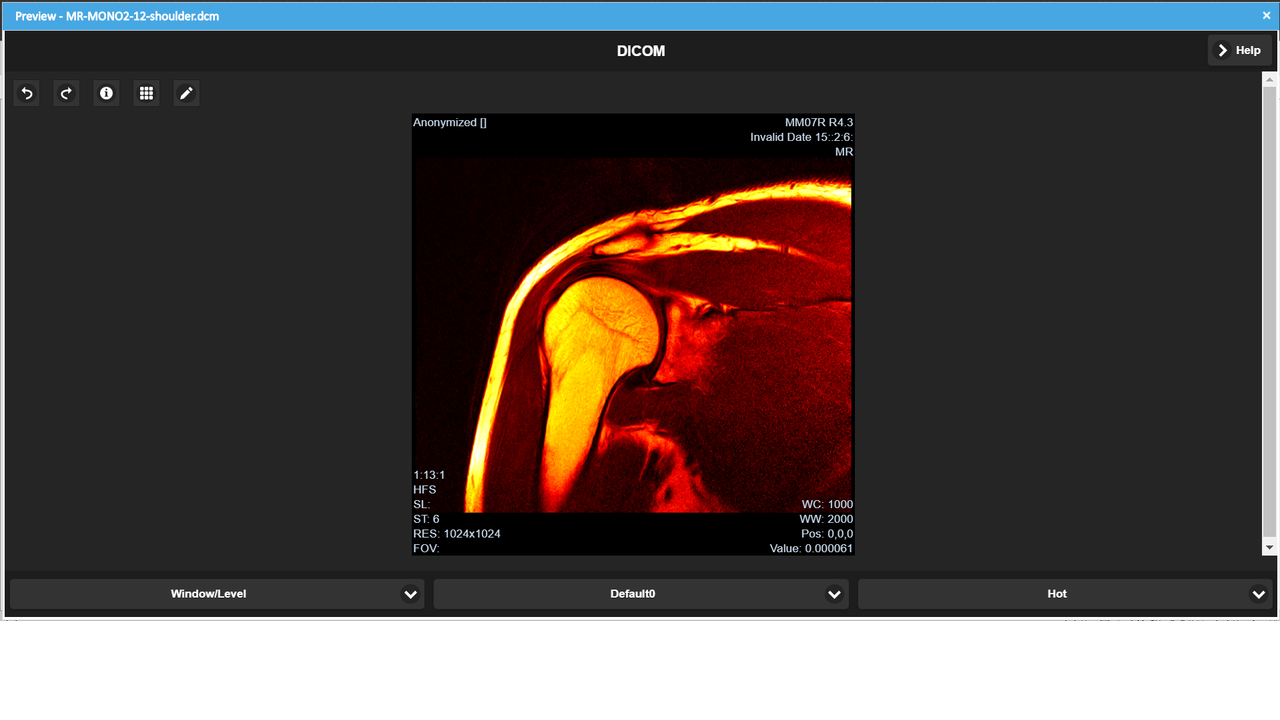 Apply Diagnostic Image Filters