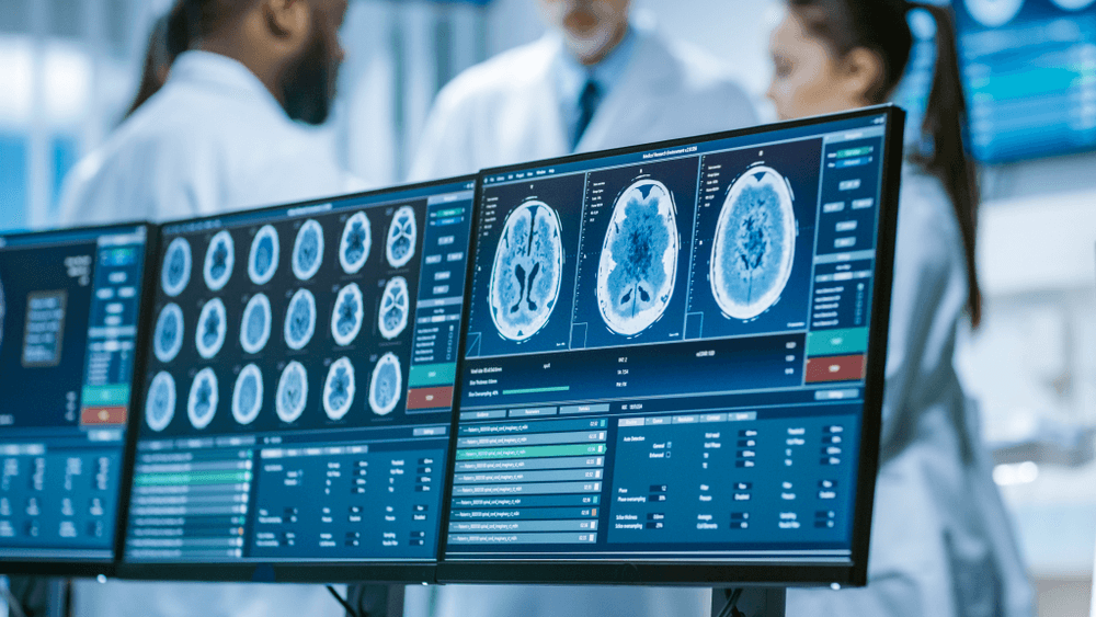 Computer Screen Showing MRI, CT Image Scan of the Brain